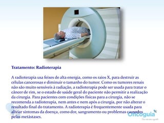 Tratamento: Radioterapia
A radioterapia usa feixes de alta energia, como os raios X, para destruir as
células cancerosas e diminuir o tamanho do tumor. Como os tumores renais
não são muito sensíveis à radiação, a radioterapia pode ser usada para tratar o
câncer de rim, se o estado de saúde geral do paciente não permitir a realização
da cirurgia. Para pacientes com condições físicas para a cirurgia, não se
recomenda a radioterapia, nem antes e nem após a cirurgia, por não alterar o
resultado final do tratamento. A radioterapia é frequentemente usada para
aliviar sintomas da doença, como dor, sangramento ou problemas causados
pelas metástases.
 