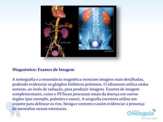 Diagnóstico: Exames de Imagem
A tomografia e a ressonância magnética mostram imagens mais detalhadas,
podendo evidenciar os gânglios linfáticos próximos. O ultrassom utiliza ondas
sonoras, ao invés de radiação, para produzir imagens. Exames de imagem
complementares, como o PETscan procuram sinais da doença em outros
órgãos (por exemplo, pulmões e ossos). A urografia excretora utiliza um
corante para delinear os rins, bexiga e ureteres e assim evidenciar a presença
de anomalias nessas estruturas.
 