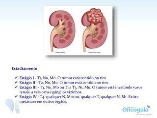 Estadiamento
 Estágio I - T1, N0, M0. O tumor está contido no rim.
 Estágio II - T2, N0, M0. O tumor está contido no rim.
 Estágio III - T3, N0, M0 ou T1 a T3, N1, M0. O tumor está invadindo vasos
renais, a veia cava e gânglios vizinhos.
 Estágio IV - T4, qualquer N, M0; ou, qualquer T, qualquer N, M1. Existe
metástase em outros órgãos.
 
