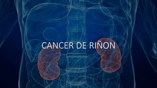 CANCER DE RIÑON
 