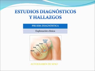 AUTOEXAMEN DE SENO PRUEBA DIAGNÓSTICA Exploración clínica 