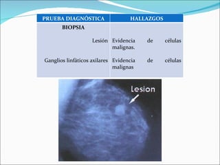 PRUEBA DIAGNÓSTICA HALLAZGOS BIOPSIA Lesión Ganglios linfáticos axilares Evidencia de células malignas. Evidencia de células malignas 