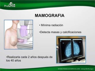 MAMOGRAFIA

                        • Mínima radiación

                        •Detecta masas y calcificaciones




•Realizarla cada 2 años después de
los 40 años
 