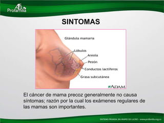 SINTOMAS




El cáncer de mama precoz generalmente no causa
síntomas; razón por la cual los exámenes regulares de
las mamas son importantes.
 