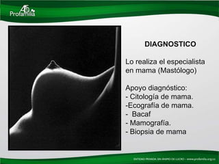 DIAGNOSTICO

Lo realiza el especialista
en mama (Mastólogo)

Apoyo diagnóstico:
- Citología de mama.
-Ecografía de mama.
- Bacaf
- Mamografía.
- Biopsia de mama
 