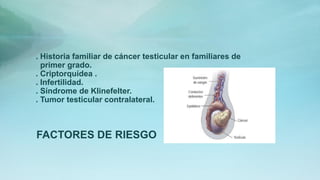 . Historia familiar de cáncer testicular en familiares de
primer grado.
. Criptorquídea .
. Infertilidad.
. Síndrome de Klinefelter.
. Tumor testicular contralateral.
FACTORES DE RIESGO
 