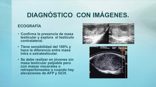 DIAGNÓSTICO CON IMÁGENES.
ECOGRAFÍA
• Confirma la presencia de masa
testicular y explora el testículo
contralateral.
• Tiene sensibilidad del 100% y
hace la diferencia entre masa
intra o extratesticular.
• Se debe realizar en jóvenes sin
masa testicular palpable pero
con masas viscerales o
retroperitoneales o cuando hay
elevaciones de AFP y GCH.
 