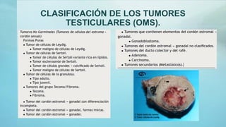 CLASIFICACIÓN DE LOS TUMORES
TESTICULARES (OMS).
 