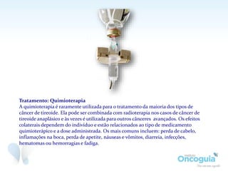 Tratamento: Quimioterapia
A quimioterapia é raramente utilizada para o tratamento da maioria dos tipos de
câncer de tireoide. Ela pode ser combinada com radioterapia nos casos de câncer de
tireoide anaplásico e às vezes é utilizada para outros cânceres avançados. Os efeitos
colaterais dependem do indivíduo e estão relacionados ao tipo de medicamento
quimioterápico e a dose administrada. Os mais comuns incluem: perda de cabelo,
inflamações na boca, perda de apetite, náuseas e vômitos, diarreia, infecções,
hematomas ou hemorragias e fadiga.
 