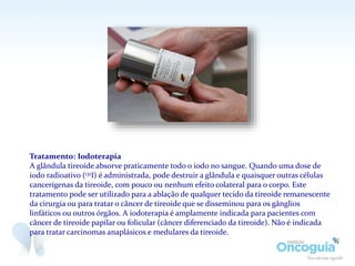 Tratamento: Iodoterapia
A glândula tireoide absorve praticamente todo o iodo no sangue. Quando uma dose de
iodo radioativo (131I) é administrada, pode destruir a glândula e quaisquer outras células
cancerígenas da tireoide, com pouco ou nenhum efeito colateral para o corpo. Este
tratamento pode ser utilizado para a ablação de qualquer tecido da tireoide remanescente
da cirurgia ou para tratar o câncer de tireoide que se disseminou para os gânglios
linfáticos ou outros órgãos. A iodoterapia é amplamente indicada para pacientes com
câncer de tireoide papilar ou folicular (câncer diferenciado da tireoide). Não é indicada
para tratar carcinomas anaplásicos e medulares da tireoide.
 