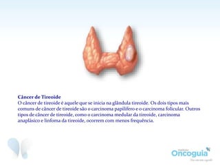 Câncer de Tireoide
O câncer de tireoide é aquele que se inicia na glândula tireoide. Os dois tipos mais
comuns de câncer de tireoide são o carcinoma papilífero e o carcinoma folicular. Outros
tipos de câncer de tireoide, como o carcinoma medular da tireoide, carcinoma
anaplásico e linfoma da tireoide, ocorrem com menos frequência.
 