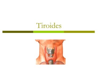 Tiroides 