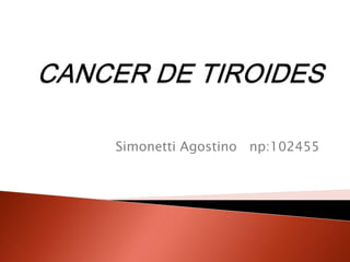 Simonetti Agostino np:102455
 