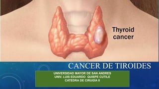 CANCER DE TIROIDES
UNIVERSIDAD MAYOR DE SAN ANDRES
UNIV. LUIS EDUARDO QUISPE CUTILE
CATEDRA DE CIRUGÍA II
 