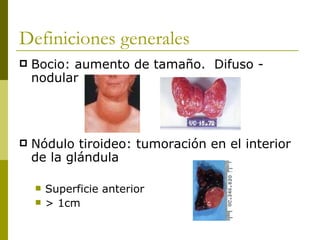 Definiciones generales
   Bocio: aumento de tamaño. Difuso -
    nodular




   Nódulo tiroideo: tumoración en el interior
    de la glándula

       Superficie anterior
       > 1cm
 