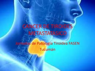 CANCER DE TIROIDES
METASTATASICO
Jornadas de Patología Tiroidea FASEN
Tucumán
 