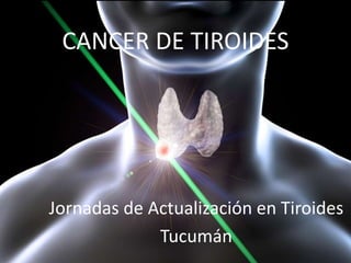 CANCER DE TIROIDES
Jornadas de Actualización en Tiroides
Tucumán
 
