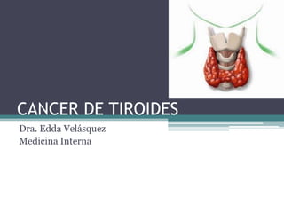 CANCER DE TIROIDES
Dra. Edda Velásquez
Medicina Interna
 