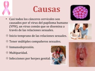 Causas  Casi todos los cánceres cervicales son causados por el virus del papiloma humano (VPH), un virus común que se disemina a través de las relaciones sexuales.  Inicio temprano de las relaciones sexuales. Tener múltiples compañeros sexuales. Inmunodepresión. Multiparidad. Infecciones por herpes genital. 