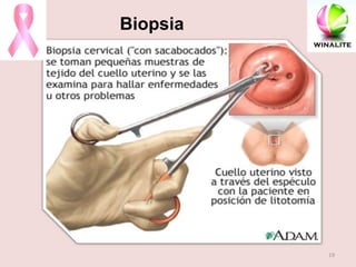Biopsia 