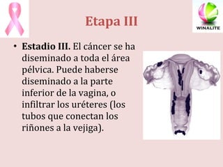Etapa III Estadio III.  El cáncer se ha diseminado a toda el área pélvica. Puede haberse diseminado a la parte inferior de la vagina, o infiltrar los uréteres (los tubos que conectan los riñones a la vejiga). 