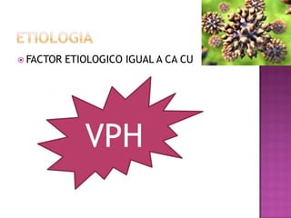  FACTOR   ETIOLOGICO IGUAL A CA CU




              VPH
 