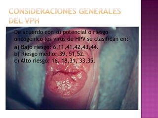 De acuerdo con su potencial o riesgo
oncogénico los virus de HPV se clasifican en:
a) Bajo riesgo: 6,11,41,42,43,44.
b) Riesgo medio:,39, 51,52.
c) Alto riesgo: 16, 18,31, 33,35.
 