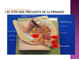  EL   SITIO MAS FRECUENTE DE CA PRIMARIO




                     22%
                                 53%

                                 5%
                                  20%
 