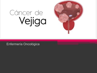 CANCER DE VEJIGA
Enfermería Oncológica
 