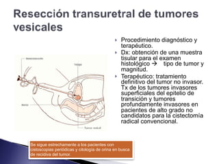 ! Procedimiento diagnóstico y
terapéutico.
! Dx: obtención de una muestra
tisular para el examen
histológico ! tipo de tumor y
magnitud.
! Terapéutico: tratamiento
definitivo del tumor no invasor. 
Tx de los tumores invasores
superficiales del epitelio de
transición y tumores
profundamente invasores en
pacientes de alto grado no
candidatos para la cistectomía
radical convencional.
Se sigue estrechamente a los pacientes con
cistoscopias periódicas y citología de orina en busca
de recidiva del tumor.
 