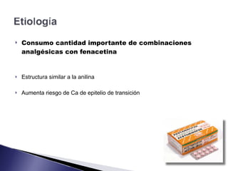 ! Consumo cantidad importante de combinaciones
analgésicas con fenacetina
! Estructura similar a la anilina
! Aumenta riesgo de Ca de epitelio de transición
 