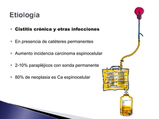 ! Cistitis crónica y otras infecciones
! En presencia de catéteres permanentes
! Aumento incidencia carcinoma espinocelular
! 2-10% parapléjicos con sonda permanente
! 80% de neoplasia es Ca espinocelular
 