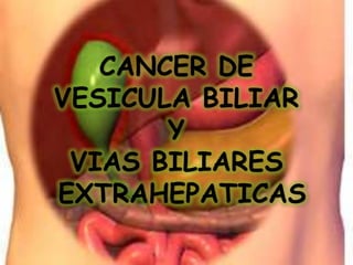 CANCER DE
VESICULA BILIAR
       Y
 VIAS BILIARES
EXTRAHEPATICAS
 