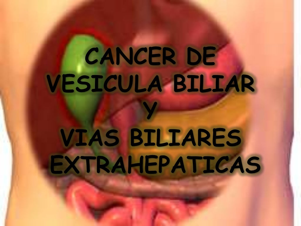 Cancer de vesicula y vias biliares
