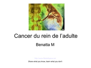 Cancer du rein de l’adulte Benatta M http://www.MedeSpace.net Share what you know, learn what you don't 