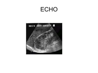 ECHO 