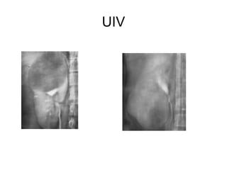 UIV 