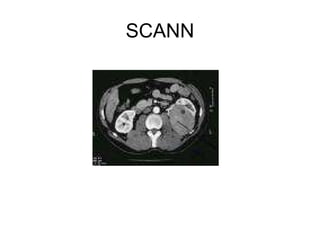 SCANN 