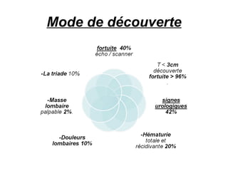 Mode de découverte 