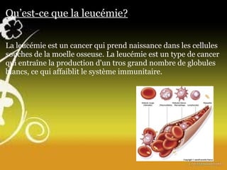 Qu’est-ce que la leucémie? La leucémie est un cancer qui prend naissance dans les cellules souches de la moelle osseuse. La leucémie est un type de cancer qui entraîne la production d'un tros grand nombre de globules blancs, ce qui affaiblit le système immunitaire.       