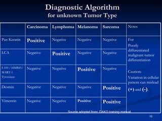 Diagnostic Algorithm for unknown Tumor Type Source adopted from: DAKO training manual Positive Positive Negative Negative Vimentin Positive Negative Negative Negative Desmin Negative Positive Negative Negative S 100 / HMB45/ MART-1 Tyrosinase Negative Negative Positive Negative LCA For Poorly differentiated malignant tumor differentiation Caution: Variation in cellular pattern can mislead (+)  and  (-) . Negative Negative Negative Positive Pan Keratin Notes Sarcoma Melanoma Lymphoma Carcinoma 