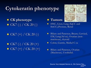 Cytokeratin phenotype CK phenotype CK7 (-) / CK 20 (-) CK7 (+) / CK 20 (-) CK7 (-) / CK 20 (+) CK7 (+) / CK 20 (+) Tumors HNC, Liver, Lung (SqCC and SmCC),Prostate, Renal Biliary and Pancreas, Breast, Cervical, EM, Lung(Ad ca), Ovarian (non-mucinous), thyroid Colon, Gastric, Markel C ca Biliary and Pancreas, Ovarian (Mucinous), Urothelial. Source: from Adopted Dennis JL, Clin Cancer Res 2005 