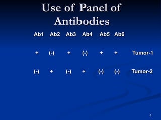 Use of Panel of Antibodies Ab1  Ab2 Ab3 Ab4  Ab5 Ab6 +  (-)  + (-)  + +  Tumor-1 (-) + (-) + (-) (-)  Tumor-2 