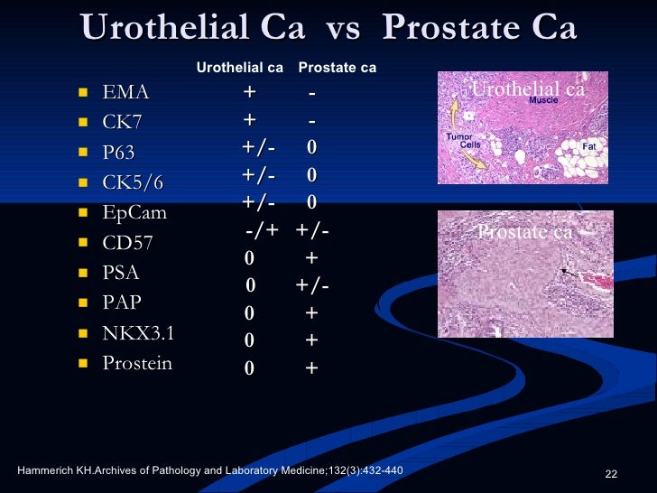 Cancer Dx Algorithm