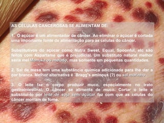AS CÉLULAS CANCEROSAS SE ALIMENTAM DE:   1.  O açúcar é um alimentador de câncer. Ao eliminar o açúcar é cortada uma importante fonte de alimentação para as células do câncer. Substitutivos do açúcar como Nutra Sweet, Equal, Spoonful, etc são feitos com Aspartame que é prejudicial. Um substituto natural melhor seria mel  Manuka ou melado , mas somente em pequenas quantidades.  2. Sal de mesa tem uma substância química adicionada para lhe dar a cor branca. Melhor alternativa é ´Bragg's aminous (?) ou  sal marinho .   3. O leite faz o corpo produzir muco, especialmente no trato gastrointestinal. O câncer se alimenta de muco. Cortar o leite e substituí-lo por  leite de soja sem açúcar  faz com que as células do câncer morram de fome. 