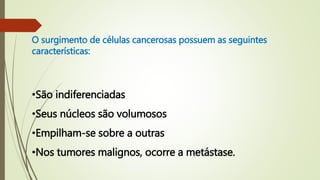 •São indiferenciadas
•Seus núcleos são volumosos
•Empilham-se sobre a outras
•Nos tumores malignos, ocorre a metástase.
O surgimento de células cancerosas possuem as seguintes
características:
 