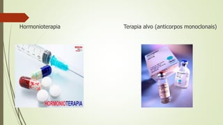 Hormonioterapia Terapia alvo (anticorpos monoclonais)
 