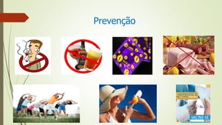 Prevenção
 