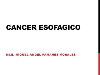 CANCER ESOFAGICO
MCE. MIGUEL ANGEL PAMANES MORALES
 