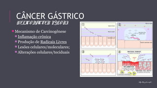 CÂNCER GÁSTRICO 
HELICOBACTER PYLORI 
Mecanismo de Carcinogênese 
 Inflamação crônica 
 Produção de Radicais Livres 
 Lesões celulares/moleculares; 
 Alterações celulares/teciduais 
http : //h. p y lo ri. info / 
 